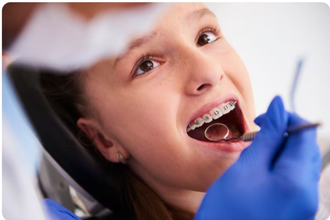 what is braces treatment and who to do in diagnopein 
